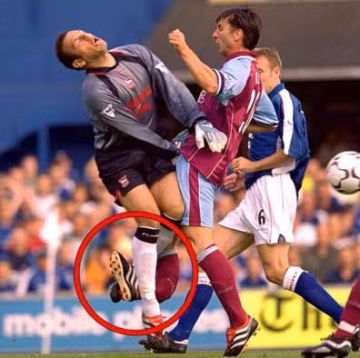 Tiền đạo người Bỉ của Aston Villa, Luca Nilis cũng phải sớm kết thúc sự nghiệp vì gãy chân trong pha va chạm với với thủ môn đội Ipswich, Richard Wright trong trận đấu tại giải Ngoại hạng Anh năm 2000.
