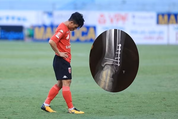 Tấn Tài là gương mặt không còn xa lạ gì với những pha vào bóng triệt hạ đối phương ở các sân chơi bóng đá Việt Nam. Cầu thủ này thi đấu năng nổ nhưng cũng không ít lần khiến người xem cảm giác hơi rợn người với những pha vào bóng kiểu đánh võ của mình.