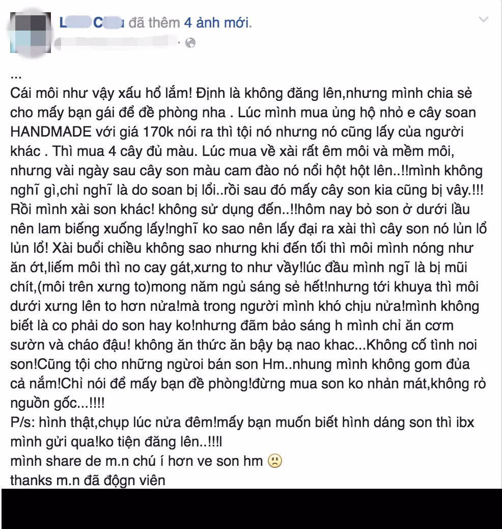 Nên tìm hiểu rõ nguồn gốc xuất xứ của sản phẩm, những khuyến cáo đi kèm... tránh gặp phải những hậu quả không muốn có.