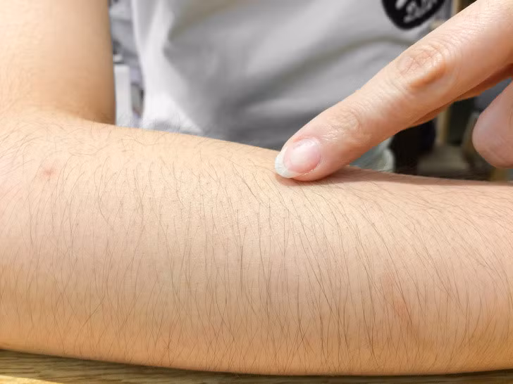 Đây cũng không phải lần đầu tiên giới trẻ Trung Quốc tự hào khoe body hair. Hồi năm 2015, hàng trăm phụ nữ đã tham gia cuộc thi ảnh khoe lông nách.