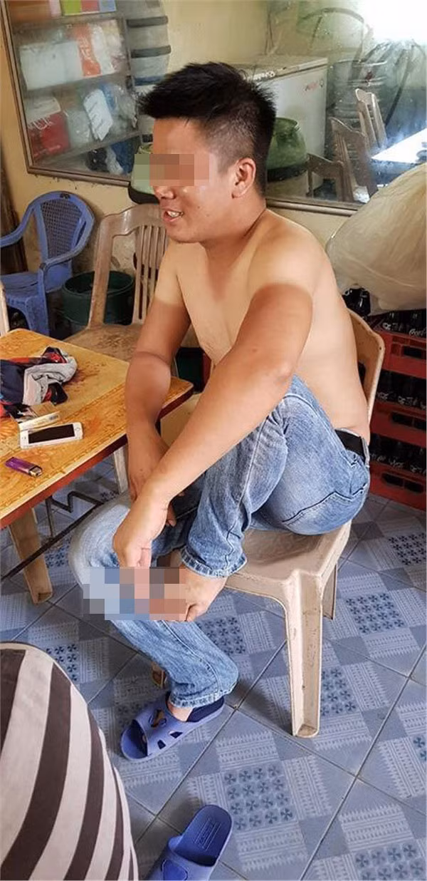 Chính những ngày nắng nóng đỉnh điểm, mới có chuyện, chỉ cần ra đường một chốc lát mà quên đồ chống nắng thì y như rằng một lát sau sẽ trở thành người khác với những vết da cháy nắng.
