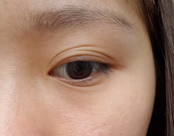 Không chỉ có các bạn trong hình, dưới bình luận hầu hết là những chia sẻ tương tự. Bạn Ngọc Anh cho hay: 'Mình cũng thế, ngủ thông cả tuần mới khỏi'.