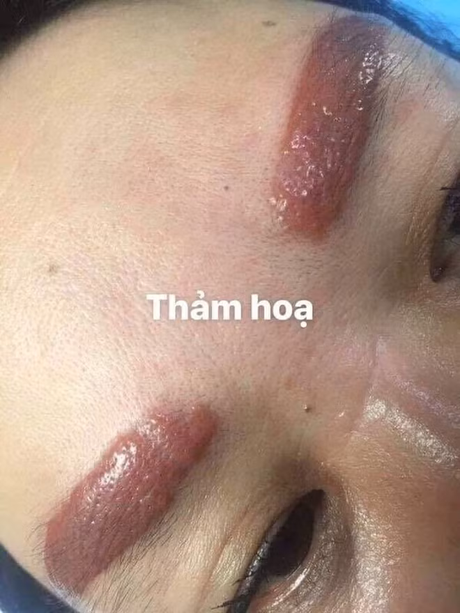 Mới đây, trong một nhóm kín trên mạng xã hội, dân mạng đã không khỏi xôn xao về những hình ảnh phun xăm thẩm mỹ phiên bản lỗi.