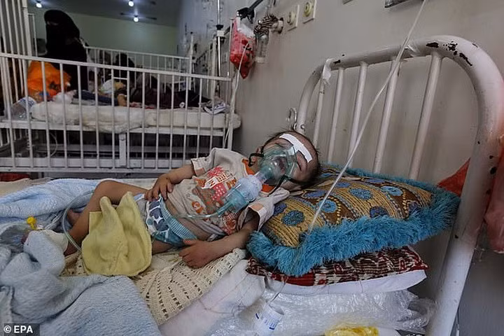 Một trẻ em Yemen khác đang phải thở oxy do bị suy dinh dưỡng nặng. Tại trung tâm này, trang thiết bị y tế thiếu thốn nghiêm trọng. Ảnh: EPA.