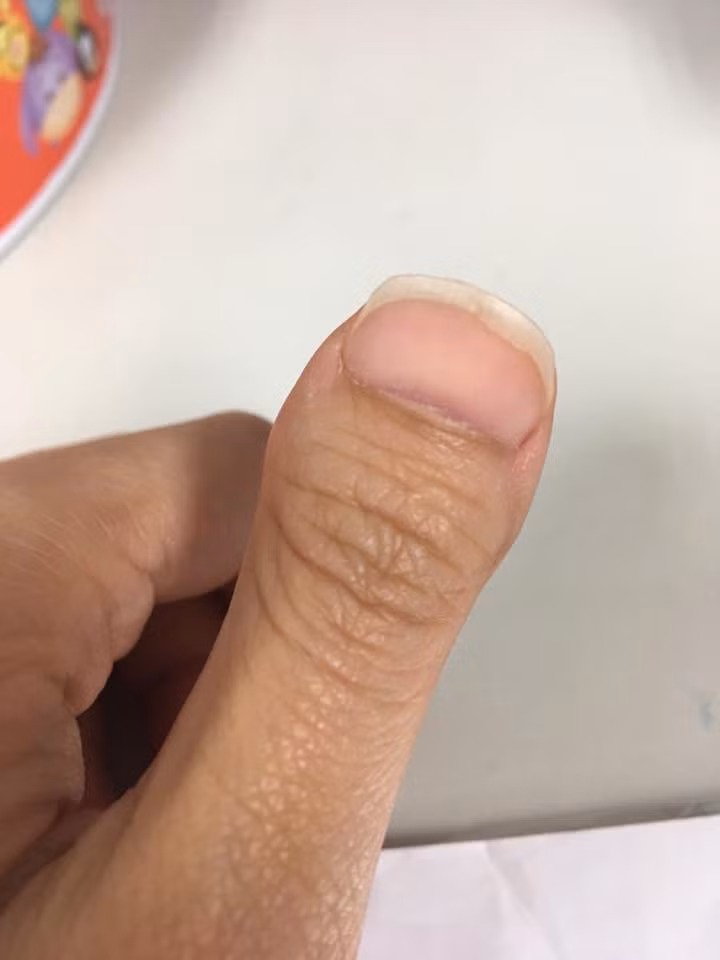 Nói thật chứ ngón tay ngắn có gì mà xấu, trông lạ lạ, yêu yêu.