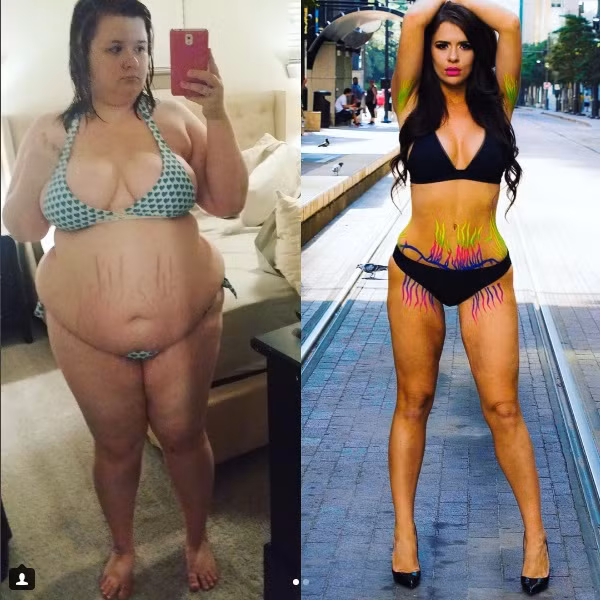Chân dung, Christine trước và sau khi phẫu thuật cắt bỏ mỡ thừa. Ảnh sử dụng trong bài: Sưu tầm Instagram.