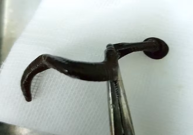 Con đỉa dài gần 15 cm được gắp ra từ khoang mũi bệnh nhi 9 tuổi. Ảnh: Bác sĩ Nguyễn Văn Tường Con đỉa dài gần 15 cm được gắp ra từ khoang mũi bệnh nhi 9 tuổi. Ảnh: Bác sĩ Nguyễn Văn Tường