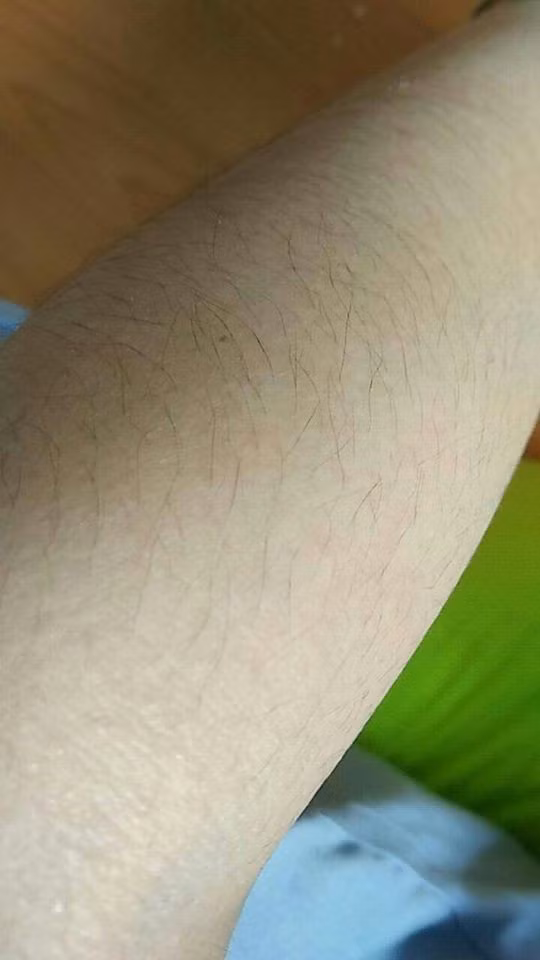 Cũng vì thế mà nhiều chị em chẳng dám diện quần short, cũng "bái bai" luôn đống váy vóc điệu đà.