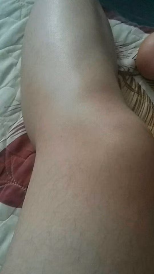 Đi kèm với những bức ảnh khoe mình thiếu may mắn là những chia sẻ của các chị em như: "Phận là con gái nhưng lông tay nhiều hơn con trai, tủi thân khủng khiếp" hay "Nhiều lúc ngồi buồn nghịch đống lông chân và tự hỏi phải chăng ông trời đã sinh nhầm giới tính cho mình?"