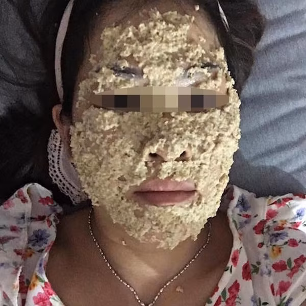Thông thường những spa hay thẩm mỹ viện có uy tín chỉ dành cho người nhiều tiền trong khi không phải ai cũng có đủ khả năng để đáp ứng điều đó. Vì vậy, một số chị em đã tự làm tại nhà bằng những nguyên liệu thiên nhiên.