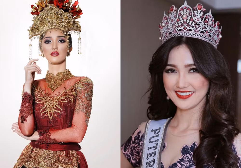 Ở độ tuổi 25, đại diện Indonesia - Sonia Fergina Citra có lợi thế về sự dày dặn kinh nghiệm cùng vẻ đẹp dịu dàng. Nhan sắc của cô được đánh giá có phần khác biệt với tiêu chí Miss Universe vốn tôn vinh vẻ đẹp sắc sảo, gợi cảm.