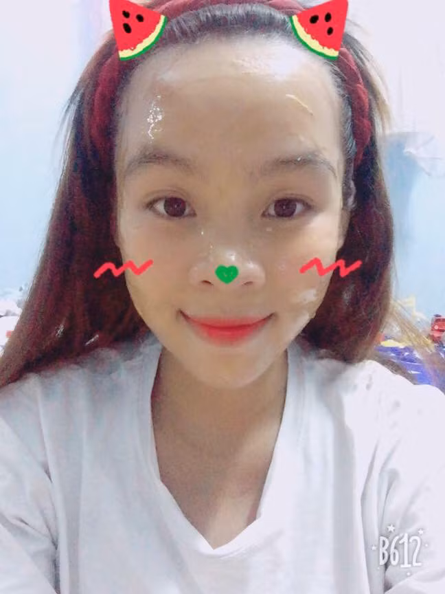 Trán cao quá thành ra trông như bị hói nhưng ít nhất bạn còn có chút an ủi là nếu bị chê lùn.