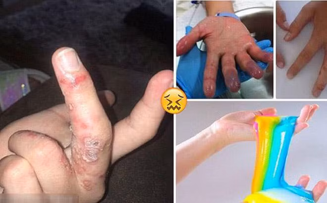 Chất nhờn ma quái Slime được nhắc đến là oại chất dẻo đặc biệt, vừa mềm vừa dẻo và rất dai…chúng có thể biển đổi thành những hình thù kỳ lạ. Chính vì thế trẻ em đặc biệt yêu thích, các em có thể tạo ra vô số hình dạng độc đáo khác nhau.