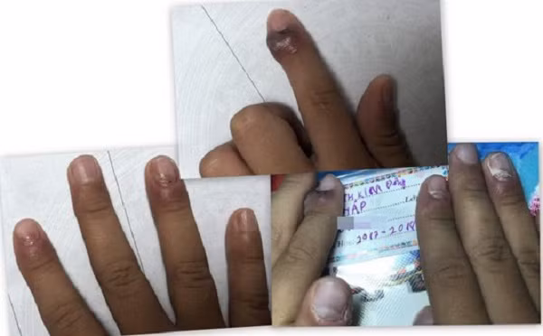 Slime được bán công khai tại các cổng trường Tiểu học, Trung học Cơ sở. Chúng được các tiểu thương nhập về hay tự chế tại nhà mà không được kiểm tra của bất cứ cơ quan an toàn chất lượng nào.