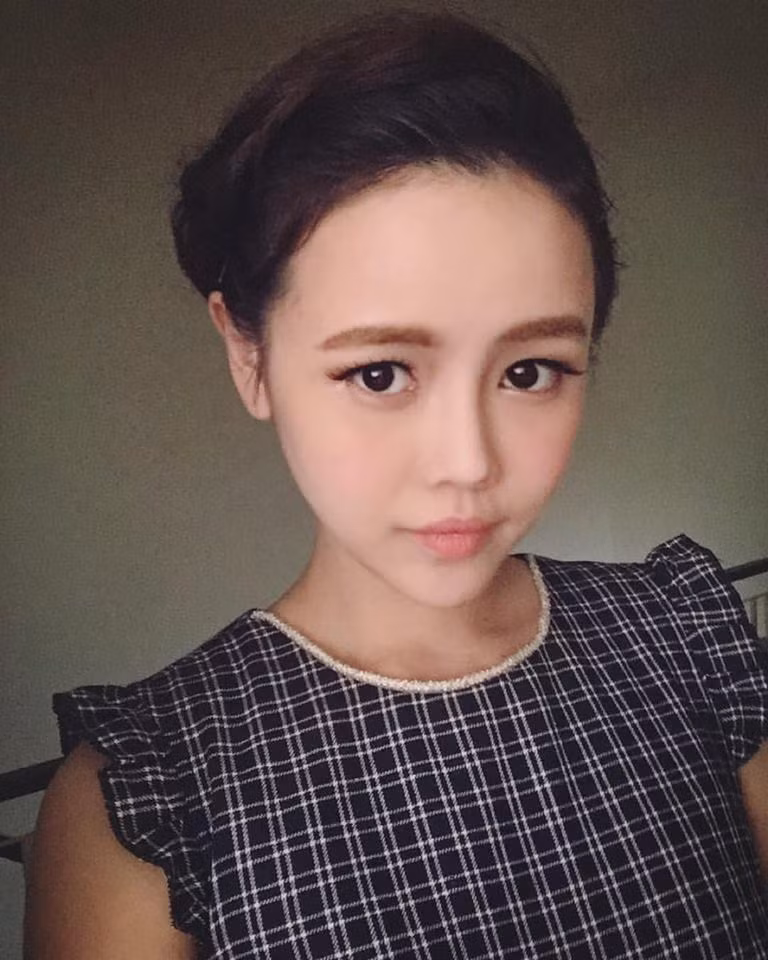Cũng theo Qiu Qiu thì chồng cô cũng rất ủng hộ cô trong việc phẫu thuật thẩm mỹ để thay đổi dung nhan.