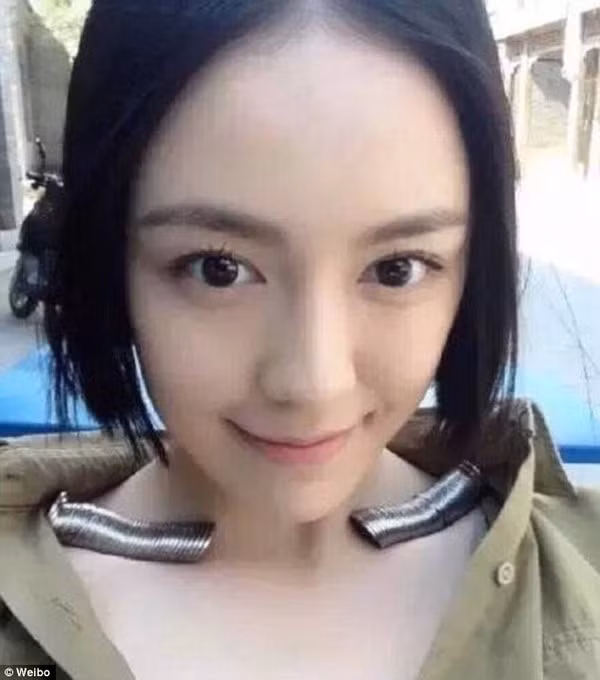 Bên cạnh đó, cũng có một số thành viên cho rằng, đi ra đường càng ngày gặp càng gặp nhiều những cô gái xanh xao, gầy guộc. Họ hay đùa nhau rằng, thời đại hiện nay mà còn một số người thiếu ăn đến mức gầy tong teo.