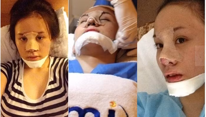 Tuy nhiên làm bộ phận nào hiện Huyền Anh vẫn chưa tiết lộ. Trước đó, Bà Tưng từng gây chú ý khi công khai phẫu thuật thẩm mỹ thu nhỏ hai bên hàm, độn cằm, chỉnh sửa lại mũi, bọc sụn và thu nhỏ đầu mũi, cánh mũi,...