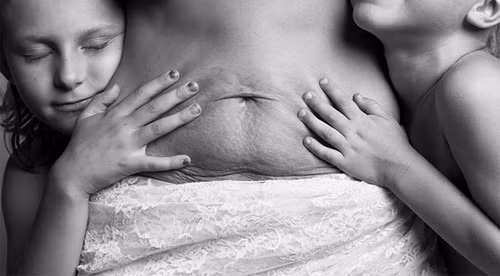 Xúc động với bộ ảnh vết rạn da của phụ nữ sau sinh: Sau khi sinh nở, nhiều phụ nữ cảm thấy tự ti về vóc dáng sồ sề cùng chiếc bụng "nứt toác" nhăn nhúm xấu xí. Lúc này, họ thường có xu hướng "làm bạn" với những bộ trang phục tối màu, suông rộng và không bao giờ nghĩ đến chuyện mặc áo tắm.