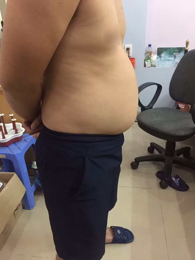 Cụ thể, cô vợ có nickname Chi Chút Chít đã kể về quá trình "thay da đổi thịt" của một chàng thanh niên được tóm tắt trong đoạn kể hài hước sau: "Một năm yêu với cả cưới, chồng mình từ 58kg lên 68kg hơn mọi người ạ. Giờ trong bụng mình đang có kết quả của hắn. Quả trứng to tròn nhất của mình được 32 tuần rồi mà trộm vía mình chả nghén gì cả. Ăn nhiều, ngủ khỏe", cô vợ nói.