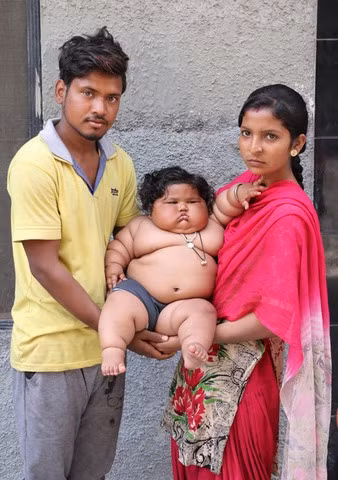Suraj, 23 tuổi, cha của bé gái Ấn Độ - Kumar, nói: “Khi con tôi sinh ra, cháu rất bình thường. Đột nhiên một ngày cháu tăng cân và lên không ngừng”. Mẹ Reena cho biết Kumar ăn gấp 4 lần một đứa bé bằng tuổi.