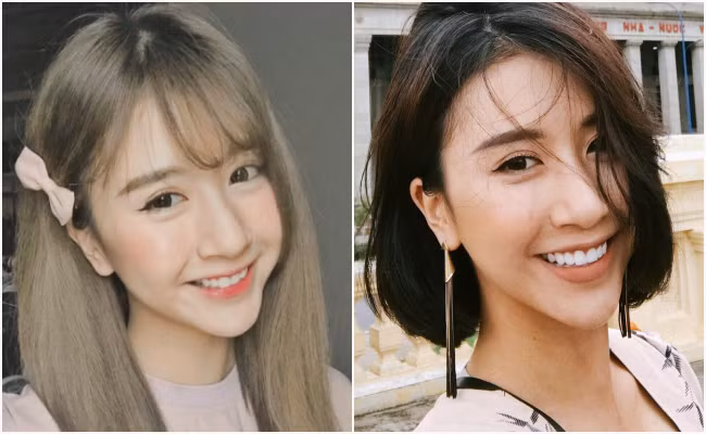 Nổi tiếng từ khi còn ngồi trên ghế THPT, Quỳnh Anh Shyn gây ấn tượng bằng gương mặt nhỏ nhắn, làn da trắng và nụ cười tươi. Tuy nhiên, thời gian gần đây nhiều người tỏ ra vô cùng bất ngờ sau khi hot girl Việt này xuất hiện trở lại với chiếc cằm V.line hơn đáng kể và câu hỏi liệu rằng Quỳnh Anh Shyn có phẫu thuật đã được dân mạng đặt ra.