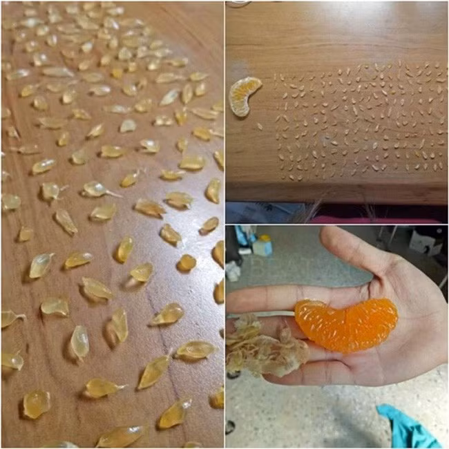 Nhặt từng tép cam ra ăn thế này khiến nhiều người đặt câu hỏi bao giờ mới nhặt hết để ăn.