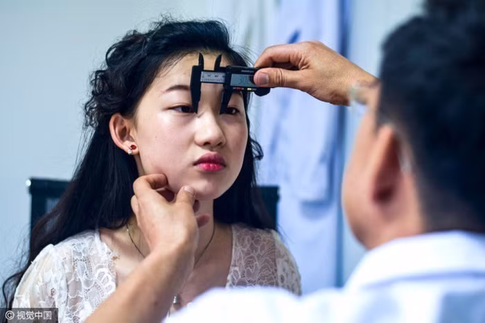 Cô bắt đầu ca phẫu thuật đầu tiên vào tháng 6/2016 với mắt và mũi sau đó là gọt cằm, môi và nhiều thủ tục khác trên khuôn mặt. Dịch Phi tin rằng, sự nghiệp của cô cô sẽ thuận lợi hơn trong tương lai khi cô thấy yêu bản thân và tự tin với vẻ ngoài của mình. Ảnh: Sina.