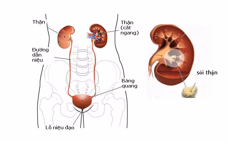 Chữa sỏi tiết niệu: Rau dừa nước (khô) 20g, kim tiền thảo 16g, ích mẫu 16g, ké đầu ngựa 12g, đinh lăng 16g, mã đề thảo 16g, trinh nữ 16g, cối xay 16g, lá tre 16g. Ngày 1 thang, sắc 3 lần uống 3 lần. 7 – 10 ngày là 1 liệu trình. Ảnh: hoanmy.com.