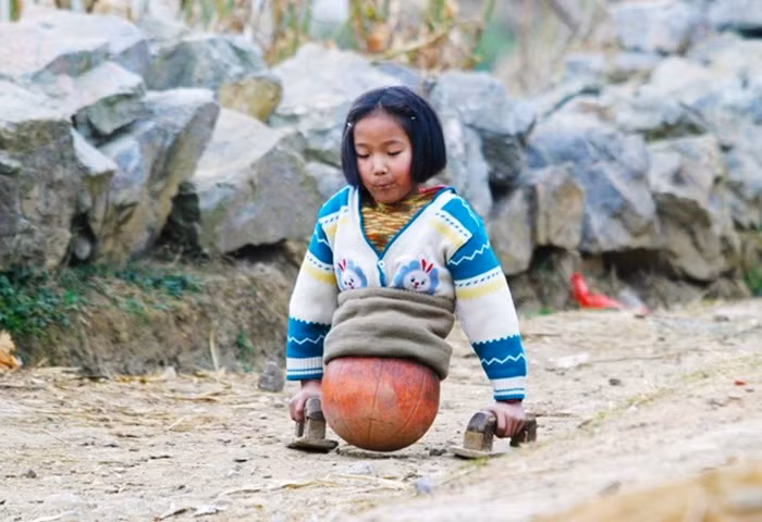 Thay vì bi quan vì khiếm khuyết cơ thể, Hongyan đã đặt mục tiêu cho bản thân. Cô học bơi và vào câu lạc bộ khuyết tật địa phương. Từ đó, cô gái này đã đạt được rất nhiều huy chương với môn thể thao dành cho người khuyết tật. Tại Trung Quốc, "cô gái bóng rổ" là biểu tượng cho lòng kiên trì, dũng cảm vượt lên khiếm khuyết cơ thể để thành công. Ảnh: Zing.