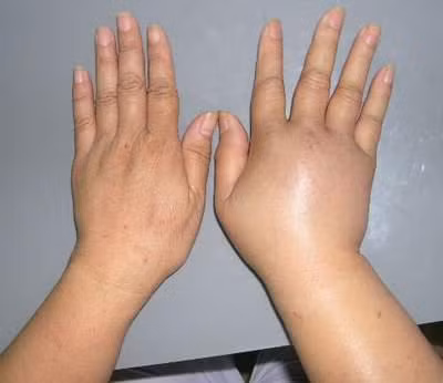 5. Chữa phù thũng, không mồ hôi, tiểu tiện đỏ: 9g hương nhu, 12g ích mẫu thảo, 30g bạch mao căn (rễ cỏ tranh) mang sắc nước uống như trà trong ngày. Dùng liên tiếp từ 10 ngày trở lên. Ảnh: vuonduocthao.com.