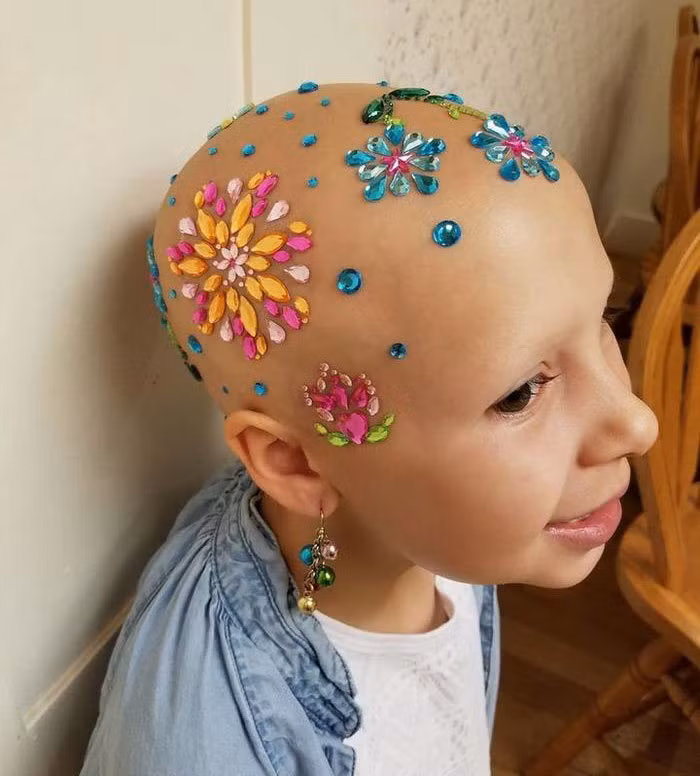 Tuy nhiên, mẹ cô bé đã nghĩ ra một cách để con thêm tự tin khi đi ra ngoài hay đến trường. Mỗi năm, mẹ cô bé lại khéo léo đeo trang sức hoặc vẽ những hình thù ngộ nghĩnh lên đầu con.