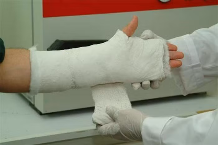 Thạch cao dùng trong y học hẳn không phải xa lạ. Nó được dùng trong ngoại khoa chấn thương để băng bó. Thế nhưng, trong Đông y, bài thuốc từ thạch cao có tác dụng bổ phế, tam tiêu, hỗ trợ tim mạch. Ảnh: Dieuduongviet.