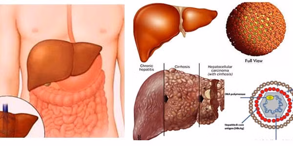 Tua rễ đa làm thuốc lợi tiểu dùng trong những trường hợp xơ gan kèm cổ trướng: Với liều 100-150g tươi trên người lớn trong 1 ngày dưới dạng thuốc sắc. Dùng liền trong vòng 7-10 ngày. Ảnh: tribenhgan.com.