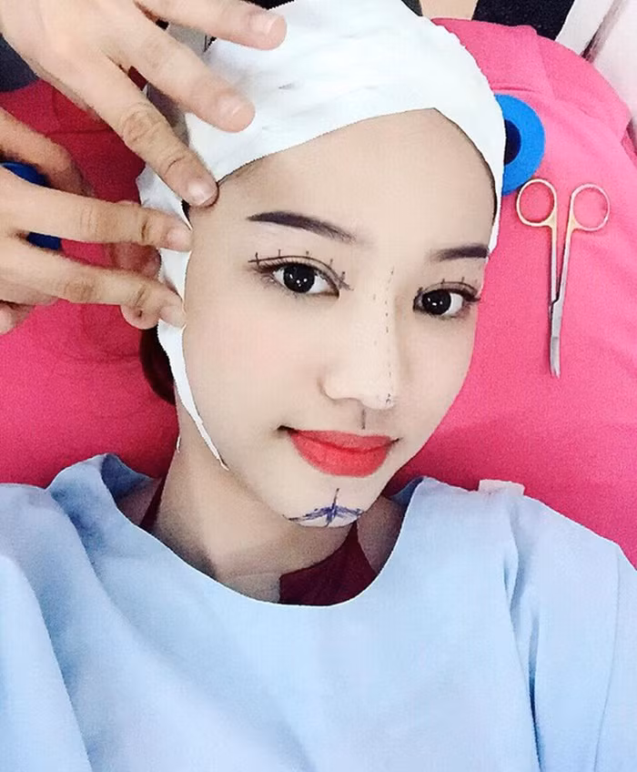 Tuy thế, cô nàng chẳng bao giờ hài lòng với kết quả thẩm mỹ của mình. Thúy Vi lại tiếp tục đăng ảnh đi tìm sắc đẹp hoàn mỹ khi đang nằm trên bàn mổ của thẩm mỹ viện. Ảnh: FBNV.