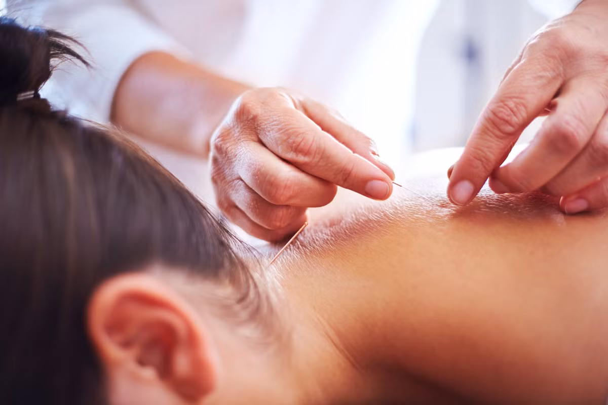Châm cứu được cho là một phương pháp trị liệu hứa hẹn trong điều trị ung thư vú. Ảnh: Time.com Châm cứu được cho là một phương pháp trị liệu hứa hẹn trong điều trị ung thư vú. Ảnh: Time.com