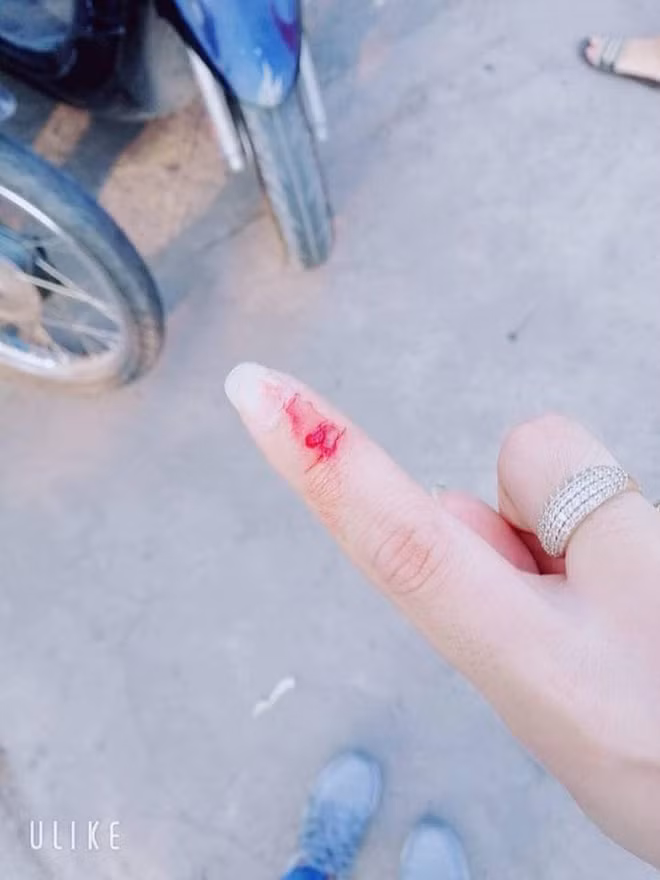 Nhac thanh nien chay xe cau tha, hai bo con bi danh chay mau giua duong-Hinh-3