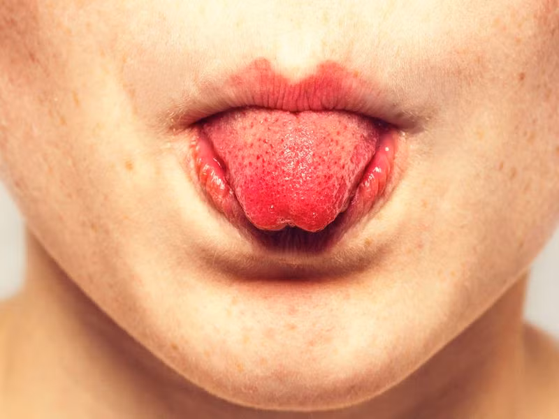 Điều này không chính xác. Trên thực tế, nhiều nghiên cứu của các chuyên gia chỉ ra các nụ vị giác được phân bố ở tất cả các vùng trong khoang miệng của mỗi người bao gồm lưỡi, lợi và họng.