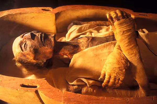 Tuy nhiên, kết quả nghiên cứu một số xác ướp của các pharaoh Ai Cập chỉ ra có không ít vua chúa mắc bệnh tật nên bị dị dạng cơ thể hay bị béo phì...