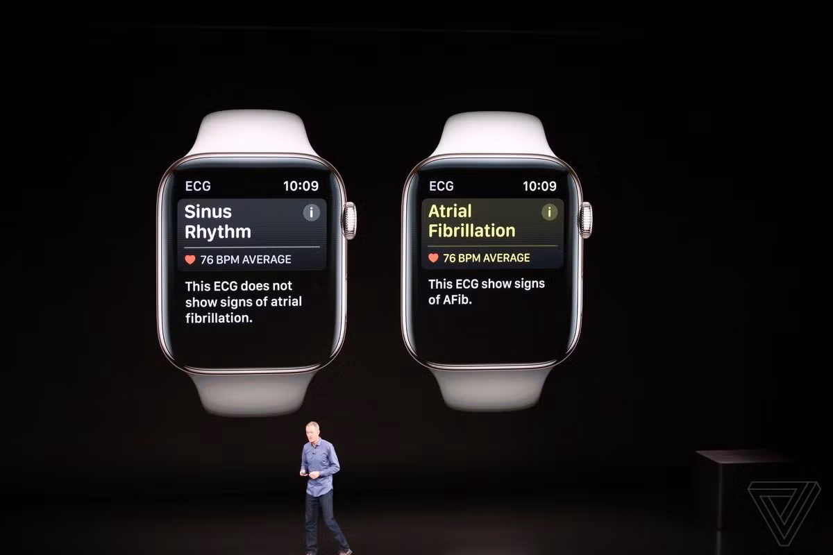 Apple Watch Series 4 có đáng để bạn "dốc hầu bao"? - Hình 2 Apple Watch Series 4 co dang de ban