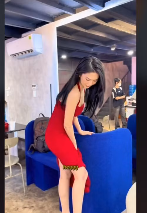 Ngọc Trinh một lần nữa chia sẻ hình ảnh vết sẹo trên chân do tai nạn mô tô. "Chị yêu nó hơn xưa, lúc mới bị té chị ghét nó lắm", cô nói về vết sẹo.