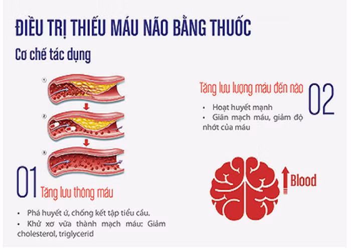 Cách điều trị thiếu máu não hiệu quả - Hình 2 Cach dieu tri thieu mau nao hieu qua-Hinh-2