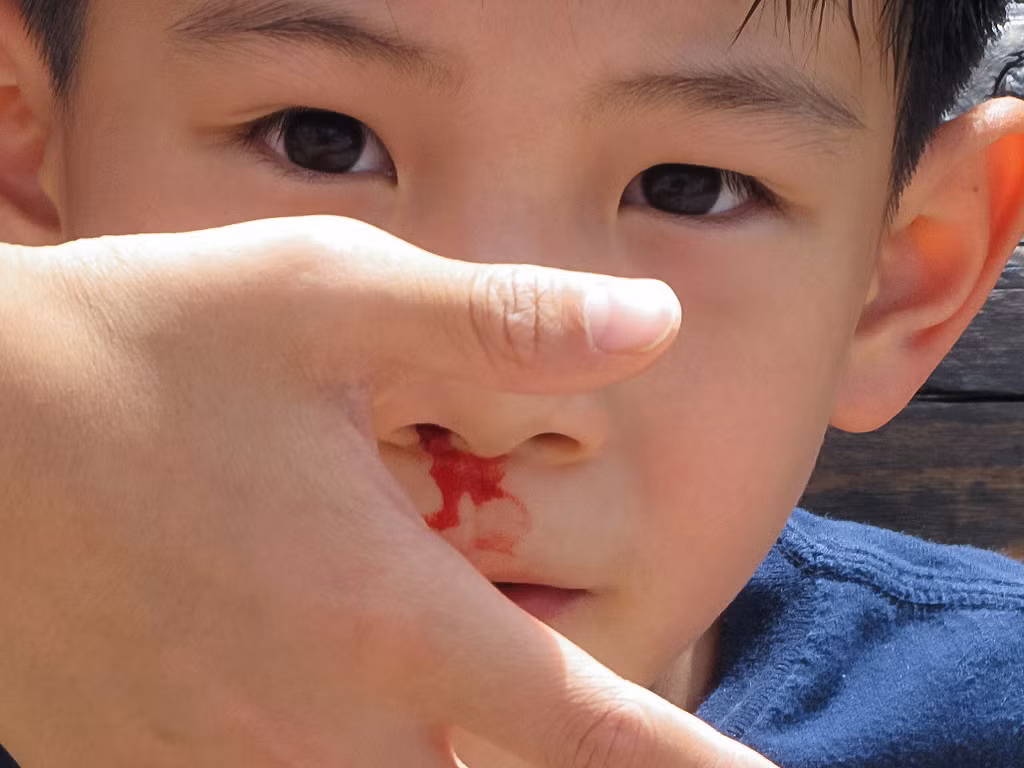 Hạ thân nhiệt bằng cách đi vào một phòng điều hòa cũng giúp hạn chế tình trạng chảy mau cam.