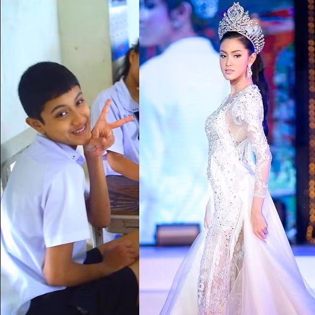 Ở tuổi 21, Nadia hạnh phúc khi được sống là chính mình. Từ khi chào đời đến năm 18 tuổi, cô luôn mặc cảm về bản thân. Hình ảnh trước phẫu thuật chuyển giới với làn da đen nhẻm của Nadia từng khiến nhiều người bất ngờ. Người đẹp sinh năm 1996 cho biết đã quyết định phẫu thuật chuyển giới ngay khi đủ 18 tuổi.