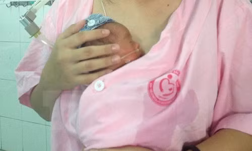 Trẻ sinh non cần được chăm sóc theo phương pháp Kangaroo với mẹ càng sớm càng tốt.
