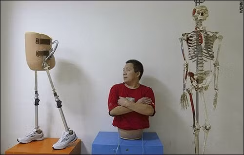 Những dị nhân “không thể tin nổi” có thật ngoài đời - Hình 5 Nhung di nhan “khong the tin noi” co that ngoai doi-Hinh-5