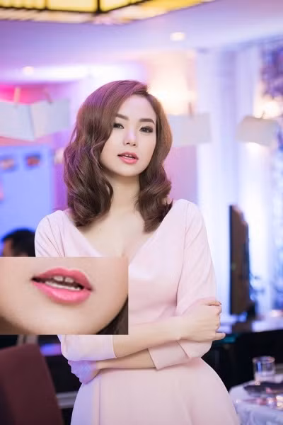 Nữ ca sĩ Minh Hằng sở hữu gương mặt dễ thương, xinh xắn. Tuy nhiên, người đẹp lại có khuyết điểm ở hàm răng với hai chiếc răng trên cửa cách xa nhau khiến khuôn miệng cô trở nên giảm bớt sự sức hút.