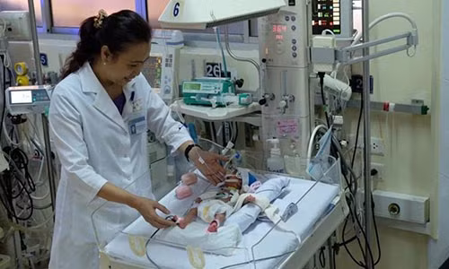 20 ngày cân não trước ca mổ tim cứu bé gái sinh non 20 ngay can nao truoc ca mo tim cuu be gai sinh non