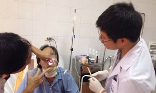 Bệnh nhân ung thư lưỡi được điều trị tại Bệnh viện Việt Nam - Cuba Bệnh nhân ung thư lưỡi được điều trị tại Bệnh viện Việt Nam - Cuba