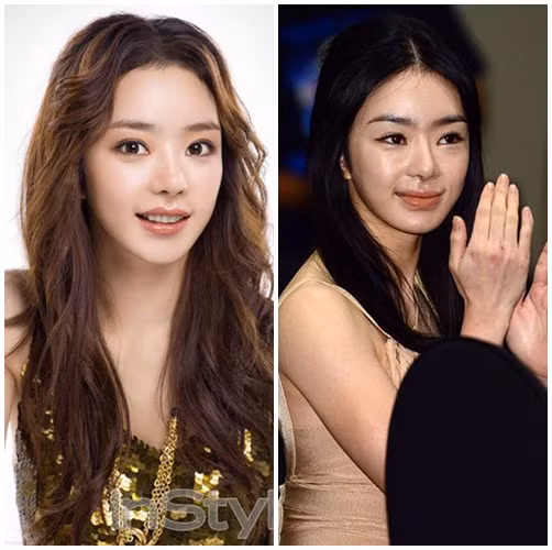 Không sở hữu một vẻ đẹp nghiêng nước nghiêng thành, nhưng Seowoo lại gây chú ý với đôi mắt ngơ ngác, khuôn mặt dễ thương cùng khả năng diễn xuất vô cùng tự nhiên. Tuy nhiên do lạm dụng thẩm mỹ vẻ đẹp vừa ngây thơ, vừa quyến rũ đã nhường lại chỗ cho gương mặt sưng vù thiếu cân xứng.