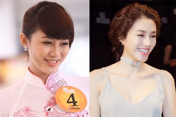Nhìn hình ảnh trước đây của Lê Hà, nhiều khán giả cho rằng cô thật sáng suốt khi đi thẩm mỹ răng.